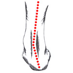 Foot Pronation